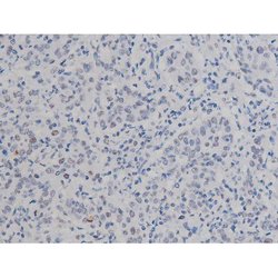 Invitrogen Phospho-NPM1 (Thr199) Polyclonal Antibody 100 &mu;L | Buy Online | Invitrogen&trade; | Fisher Scientific