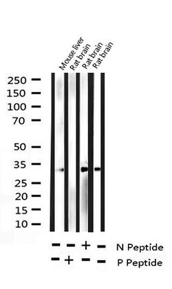 Invitrogen Phospho-NPM1 (Thr199) Polyclonal Antibody 100 &mu;L | Buy Online | Invitrogen&trade; | Fisher Scientific