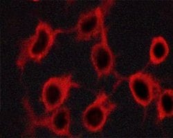 Invitrogen Phospho-Tyrosine Hydroxylase (Ser19) Polyclonal Antibody 100