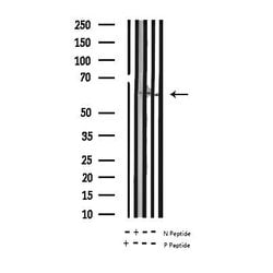 Invitrogen Phospho-Tyrosine Hydroxylase (Ser19) Polyclonal Antibody 100