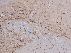 Invitrogen Phospho-Tyrosine Hydroxylase (Ser31) Polyclonal Antibody 100