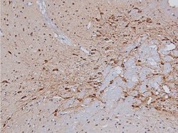 Invitrogen Phospho-Tyrosine Hydroxylase (Ser31) Polyclonal Antibody 100