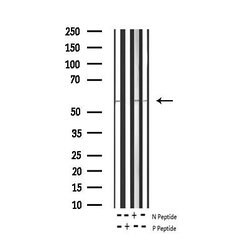 Invitrogen Phospho-Tyrosine Hydroxylase (Ser31) Polyclonal Antibody 100
