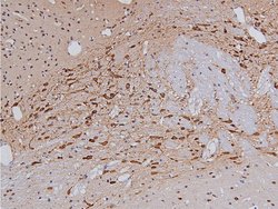 Phospho-Tyrosine Hydroxylase (Ser40) Polyclonal Antibody, Invitrogen 100