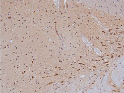 Phospho-Tyrosine Hydroxylase (Ser40) Polyclonal Antibody, Invitrogen 100