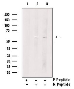 Phospho-Tyrosine Hydroxylase (Ser40) Polyclonal Antibody, Invitrogen 100