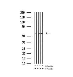 Phospho-Tyrosine Hydroxylase (Ser40) Polyclonal Antibody, Invitrogen 100