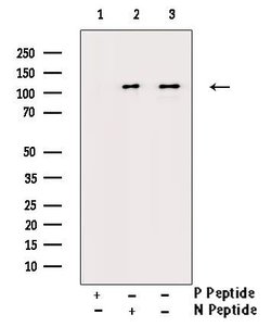 Invitrogen Phospho-CSF1R (Tyr809) Polyclonal Antibody 100 &mu;L | Buy Online | Invitrogen&trade; | Fisher Scientific