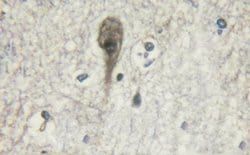 Invitrogen Phospho-beta-2 Adrenergic Receptor (Ser346) Polyclonal Antibody