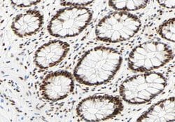 Invitrogen Phospho-hnRNP C (Ser260) Polyclonal Antibody 100 &mu;L | Buy Online | Invitrogen&trade; | Fisher Scientific