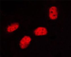 Invitrogen Phospho-SP1 (Thr453) Polyclonal Antibody 100 μL; Unconjugated:Antibodies,