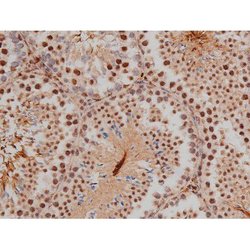 Invitrogen Phospho-SP1 (Thr453) Polyclonal Antibody 100 μL; Unconjugated:Antibodies,
