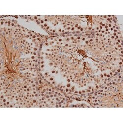 Invitrogen Phospho-SP1 (Thr453) Polyclonal Antibody 100 μL; Unconjugated:Antibodies,
