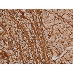 Invitrogen Phospho-SP1 (Thr453) Polyclonal Antibody 100 μL; Unconjugated:Antibodies,