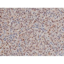 Invitrogen Phospho-SP1 (Thr453) Polyclonal Antibody 100 μL; Unconjugated:Antibodies,