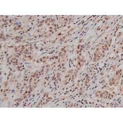 Invitrogen Phospho-SP1 (Thr453) Polyclonal Antibody 100 μL; Unconjugated:Antibodies,