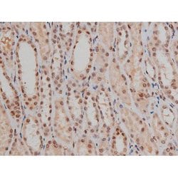Invitrogen Phospho-SP1 (Thr453) Polyclonal Antibody 100 μL; Unconjugated:Antibodies,