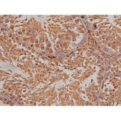 Invitrogen Phospho-SP1 (Thr739) Polyclonal Antibody 100 &mu;L; Unconjugated:Antibodies,