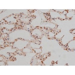 Invitrogen Phospho-SP1 (Thr739) Polyclonal Antibody 100 &mu;L; Unconjugated:Antibodies,