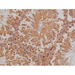Invitrogen Phospho-SP1 (Thr739) Polyclonal Antibody 100 &mu;L; Unconjugated:Antibodies,