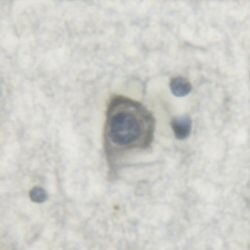 Invitrogen Phospho-IGF1R (Tyr1346) Polyclonal Antibody 100 &mu;L; Unconjugated:Antibodies,