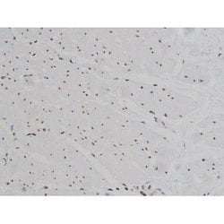 Invitrogen Phospho-IGF1R (Tyr1346) Polyclonal Antibody 100 &mu;L; Unconjugated:Antibodies,