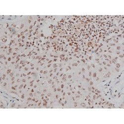 Invitrogen Phospho-IGF1R (Tyr1346) Polyclonal Antibody 100 &mu;L; Unconjugated:Antibodies,