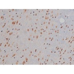Invitrogen Phospho-IGF1R (Tyr1346) Polyclonal Antibody 100 &mu;L; Unconjugated:Antibodies,