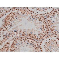 Invitrogen Phospho-IGF1R (Tyr1346) Polyclonal Antibody 100 &mu;L; Unconjugated:Antibodies,