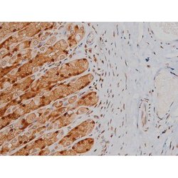 Invitrogen Phospho-IGF1R (Tyr1346) Polyclonal Antibody 100 &mu;L; Unconjugated:Antibodies,