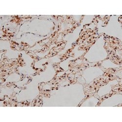 Invitrogen Phospho-IGF1R (Tyr1346) Polyclonal Antibody 100 &mu;L; Unconjugated:Antibodies,
