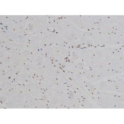 Invitrogen Phospho-IGF1R (Tyr1346) Polyclonal Antibody 100 &mu;L; Unconjugated:Antibodies,