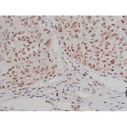Invitrogen Phospho-IGF1R (Tyr1346) Polyclonal Antibody 100 &mu;L; Unconjugated:Antibodies,