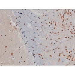 Invitrogen Phospho-IGF1R (Tyr1346) Polyclonal Antibody 100 &mu;L; Unconjugated:Antibodies,