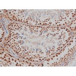 Invitrogen Phospho-IGF1R (Tyr1346) Polyclonal Antibody 100 &mu;L; Unconjugated:Antibodies,