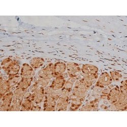 Invitrogen Phospho-IGF1R (Tyr1346) Polyclonal Antibody 100 &mu;L; Unconjugated:Antibodies,