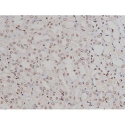 Invitrogen Phospho-IGF1R (Tyr1346) Polyclonal Antibody 100 &mu;L; Unconjugated:Antibodies,