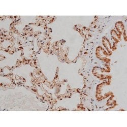 Invitrogen Phospho-IGF1R (Tyr1346) Polyclonal Antibody 100 &mu;L; Unconjugated:Antibodies,