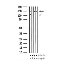 Invitrogen Phospho-IGF1R (Tyr1346) Polyclonal Antibody 100 &mu;L; Unconjugated:Antibodies,