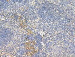 Invitrogen Phospho-IGF1R (Tyr1161) Polyclonal Antibody 100 &mu;L; Unconjugated:Antibodies,