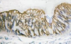 Invitrogen Phospho-PDGFRB (Tyr740) Polyclonal Antibody 100 &mu;L | Buy Online | Invitrogen&trade; | Fisher Scientific