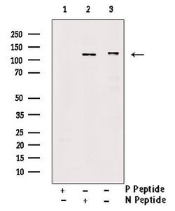 Invitrogen Phospho-PDGFRb (Tyr771) Polyclonal Antibody 100 &mu;L; Unconjugated:Antibodies,
