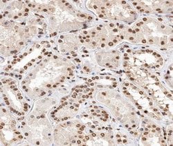 Invitrogen Phospho-Histone H2A (Thr121) Polyclonal Antibody 100 &mu;L;