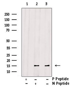 Invitrogen Phospho-Histone H2A (Thr121) Polyclonal Antibody 100 &mu;L;
