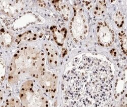 Invitrogen Phospho-BCL-2 (Thr69) Polyclonal Antibody 100 &mu;L; Unconjugated:Antibodies,