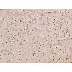 Invitrogen Phospho-Tau (Ser235) Polyclonal Antibody 100 &mu;L | Buy Online | Invitrogen&trade; | Fisher Scientific