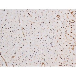 Invitrogen Phospho-Tau (Ser235) Polyclonal Antibody 100 &mu;L | Buy Online | Invitrogen&trade; | Fisher Scientific