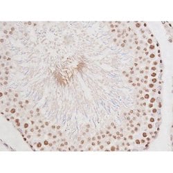 Invitrogen Phospho-Tau (Ser235) Polyclonal Antibody 100 &mu;L | Buy Online | Invitrogen&trade; | Fisher Scientific