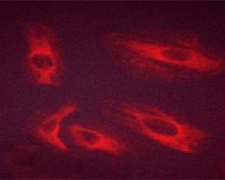 Invitrogen Phospho-FGFR1 (Tyr654) Polyclonal Antibody 100 &mu;L; Unconjugated:Antibodies,