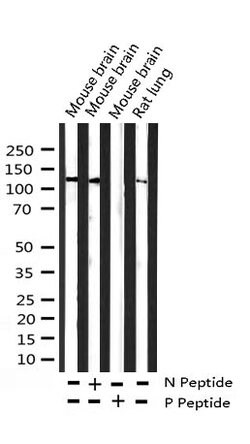 Invitrogen Phospho-FGFR1 (Tyr654) Polyclonal Antibody 100 &mu;L; Unconjugated:Antibodies,